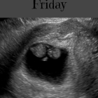 My Blackest Friday:  a Pregnancy Loss