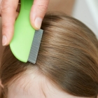 The Best Way to Get Rid of Head Lice