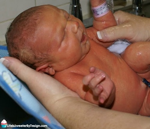 newborns skin