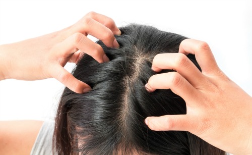 ways to get rid of head lice