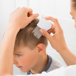 tips to prevent head lice