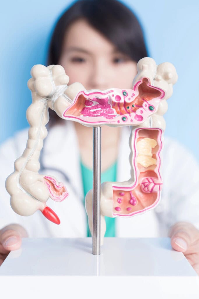 model of colon, foods rich in prebiotics and probiotics