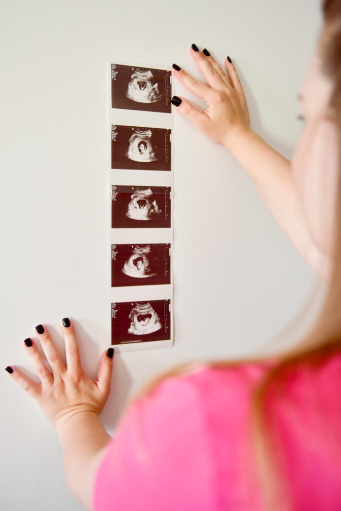 ultrasound pictures