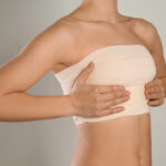 Want Natural-Looking Results? 5 Reasons to Consider a Breast Lift