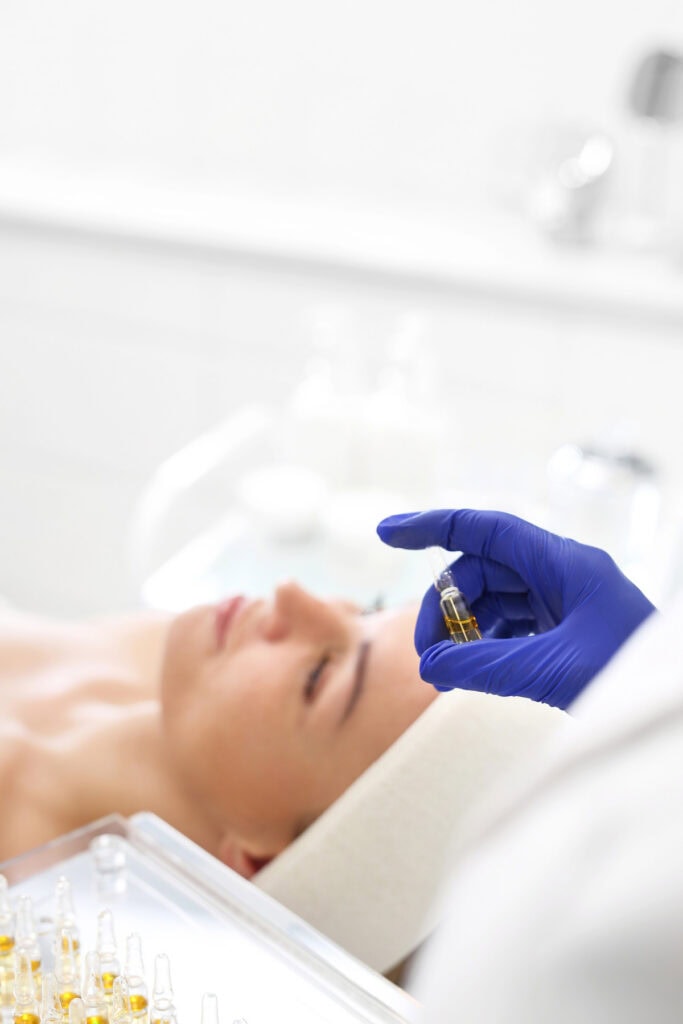 what happens during a chemical peel