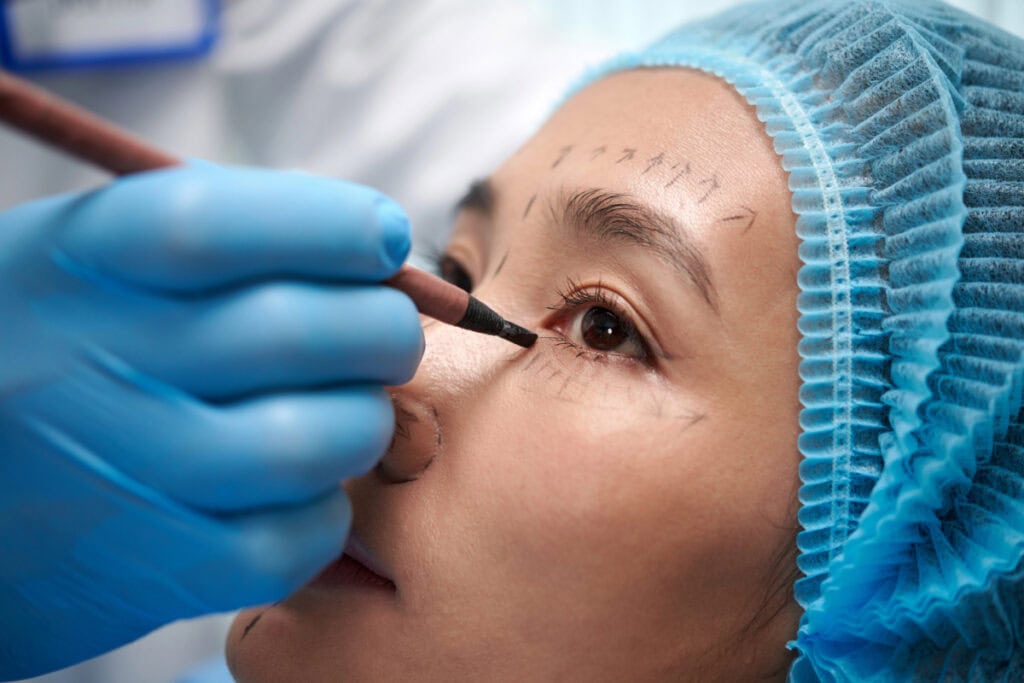 benefits of choosing blepharoplasty