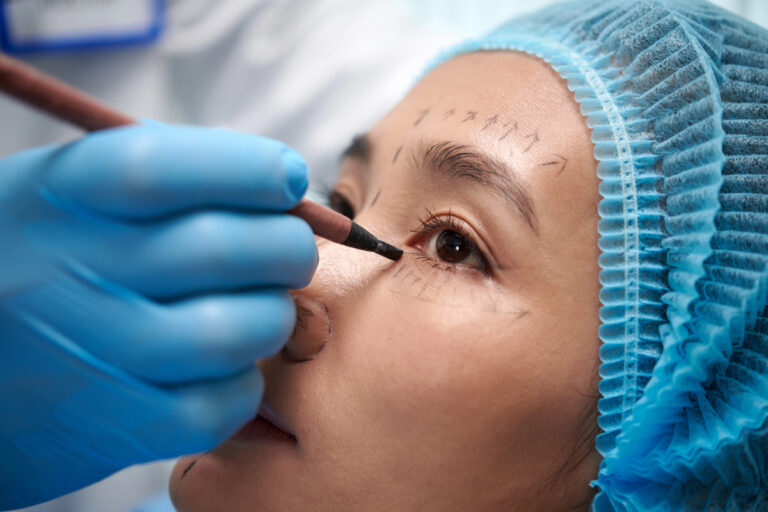 benefits of choosing blepharoplasty