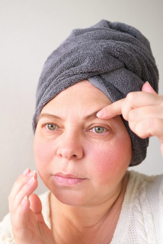 eyelift surgery