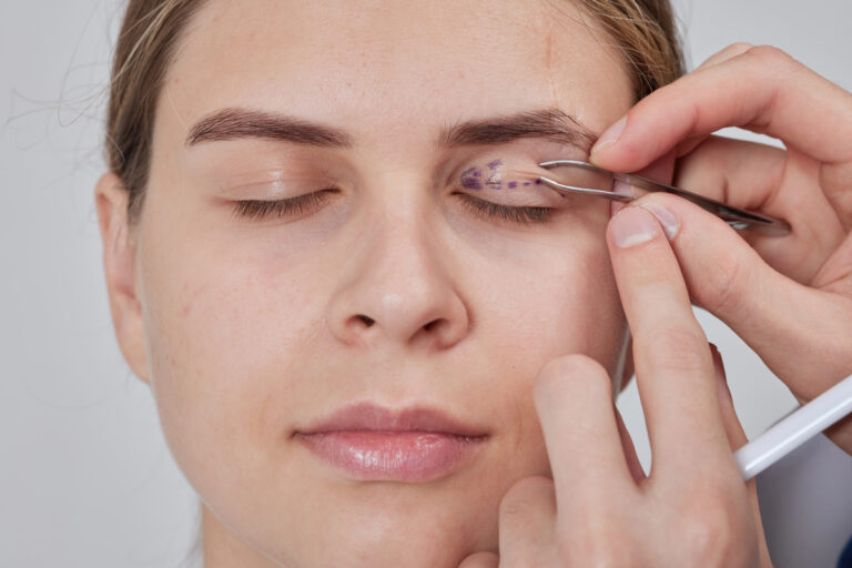 eyelift surgery