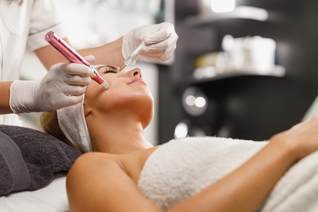 microneedling results