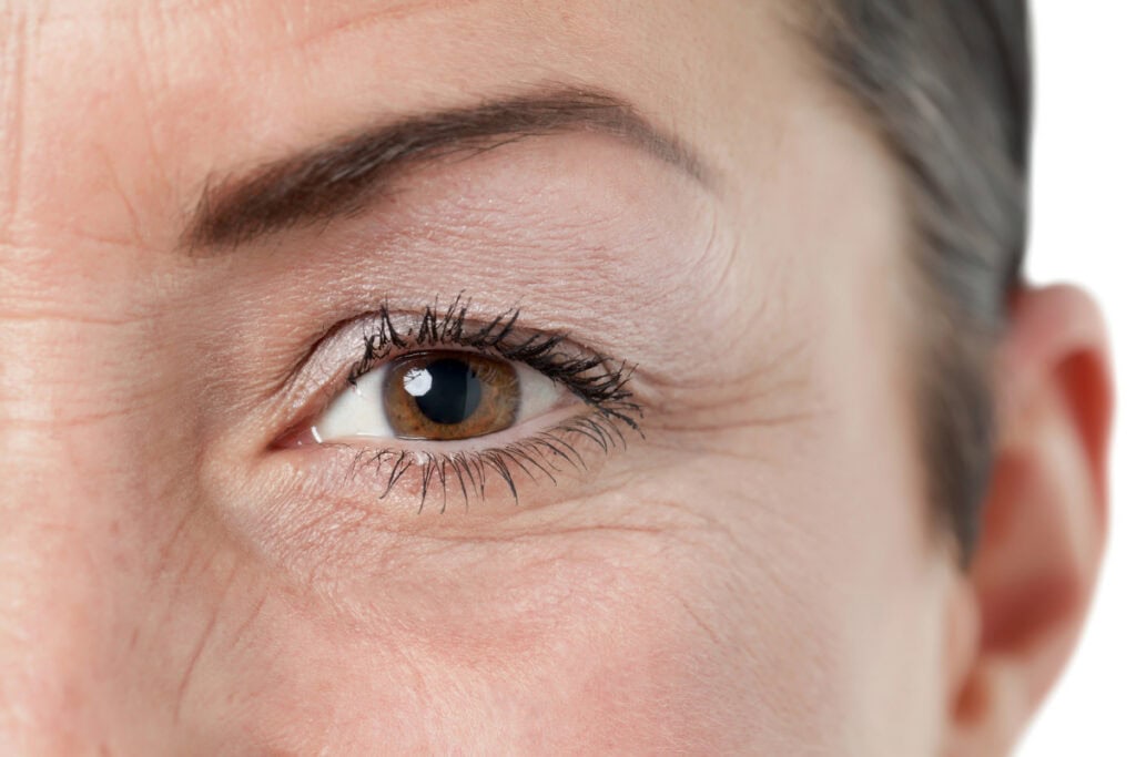 how to plan a blepharoplasty procedure