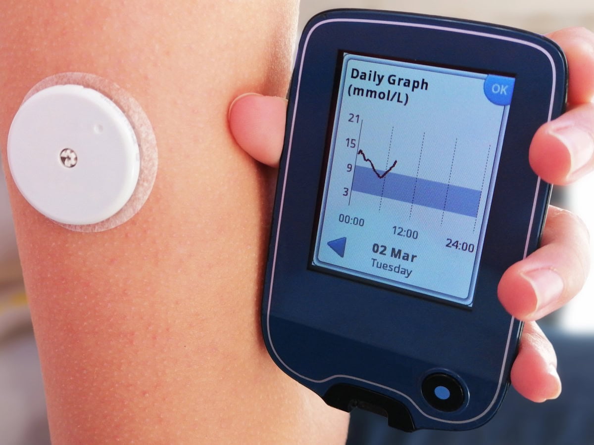 continuous glucose montior online