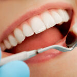 What Counts as a True Dental Emergency Versus a Minor Issue