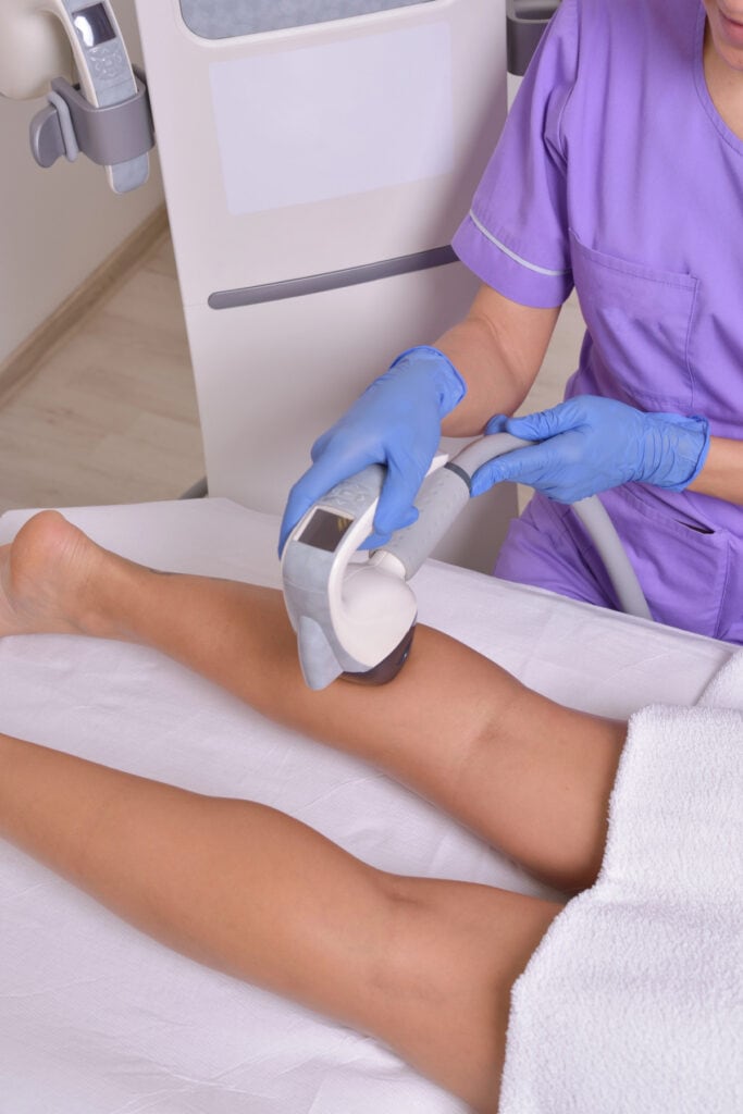 laser hair removal